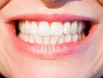 woman's teeth 